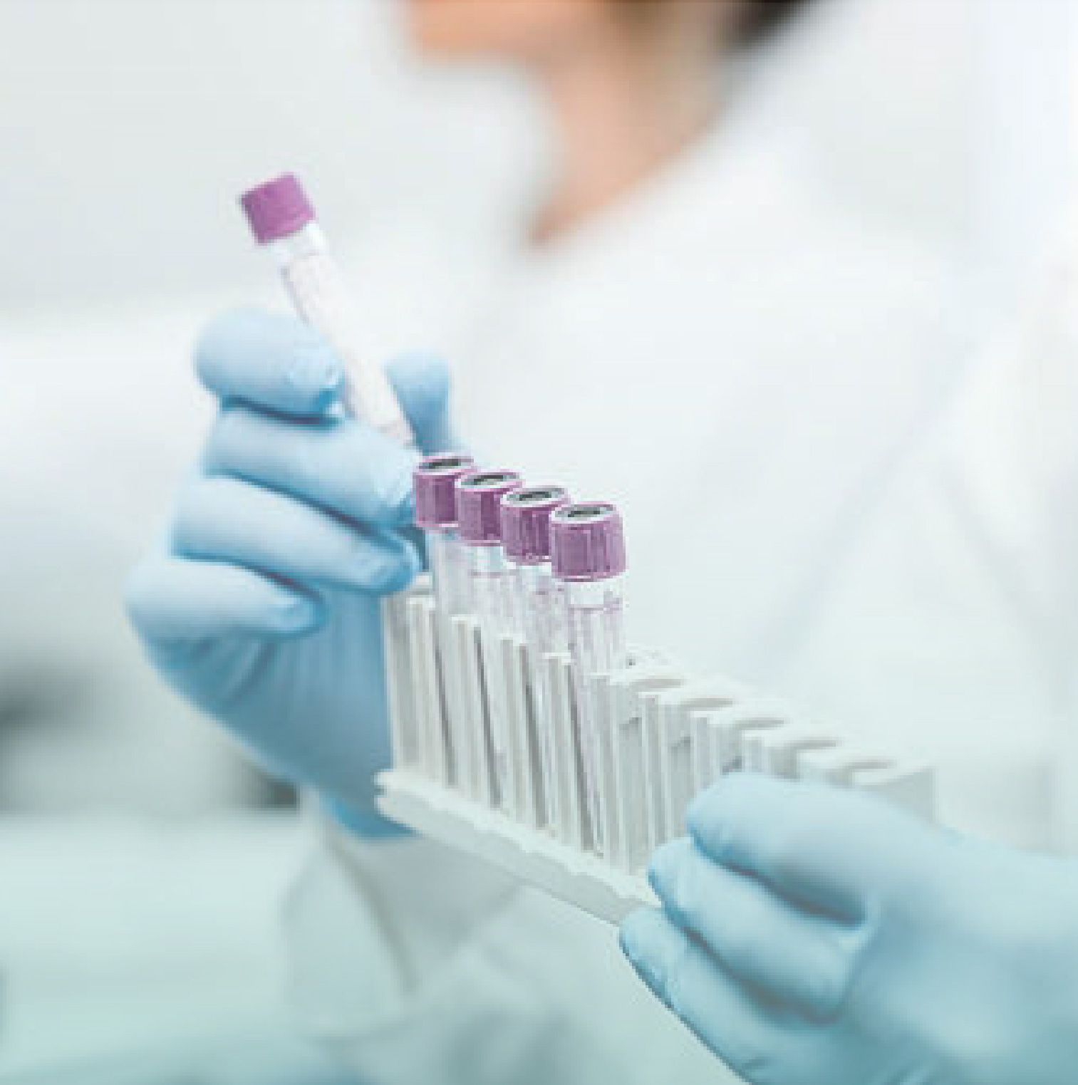 Labratory Testing Rugby Labratory tests - Yugen Care